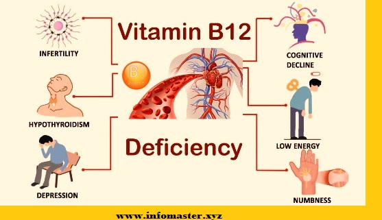 Vitamin B12 DEficiency