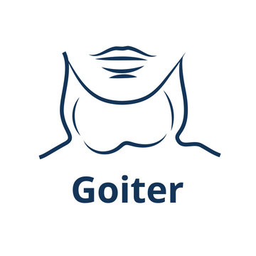 goiter Remedies from its disease