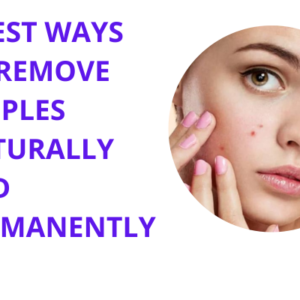 Best ways to remove pimples naturally